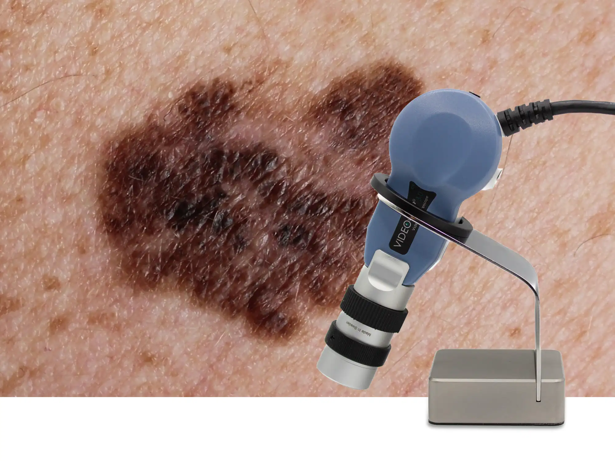 Linea Videocap Derma