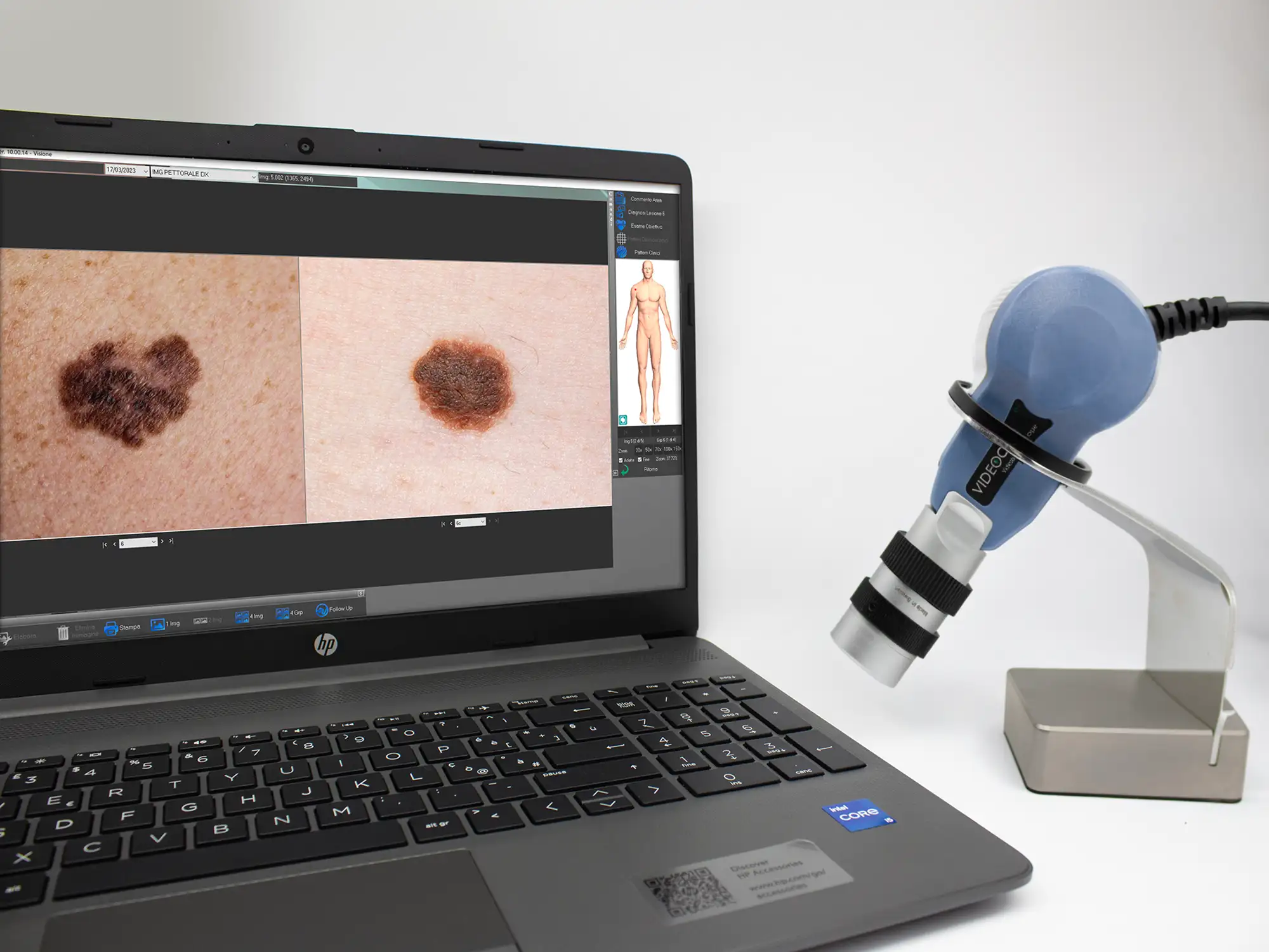 Kit Videocap Derma Basic