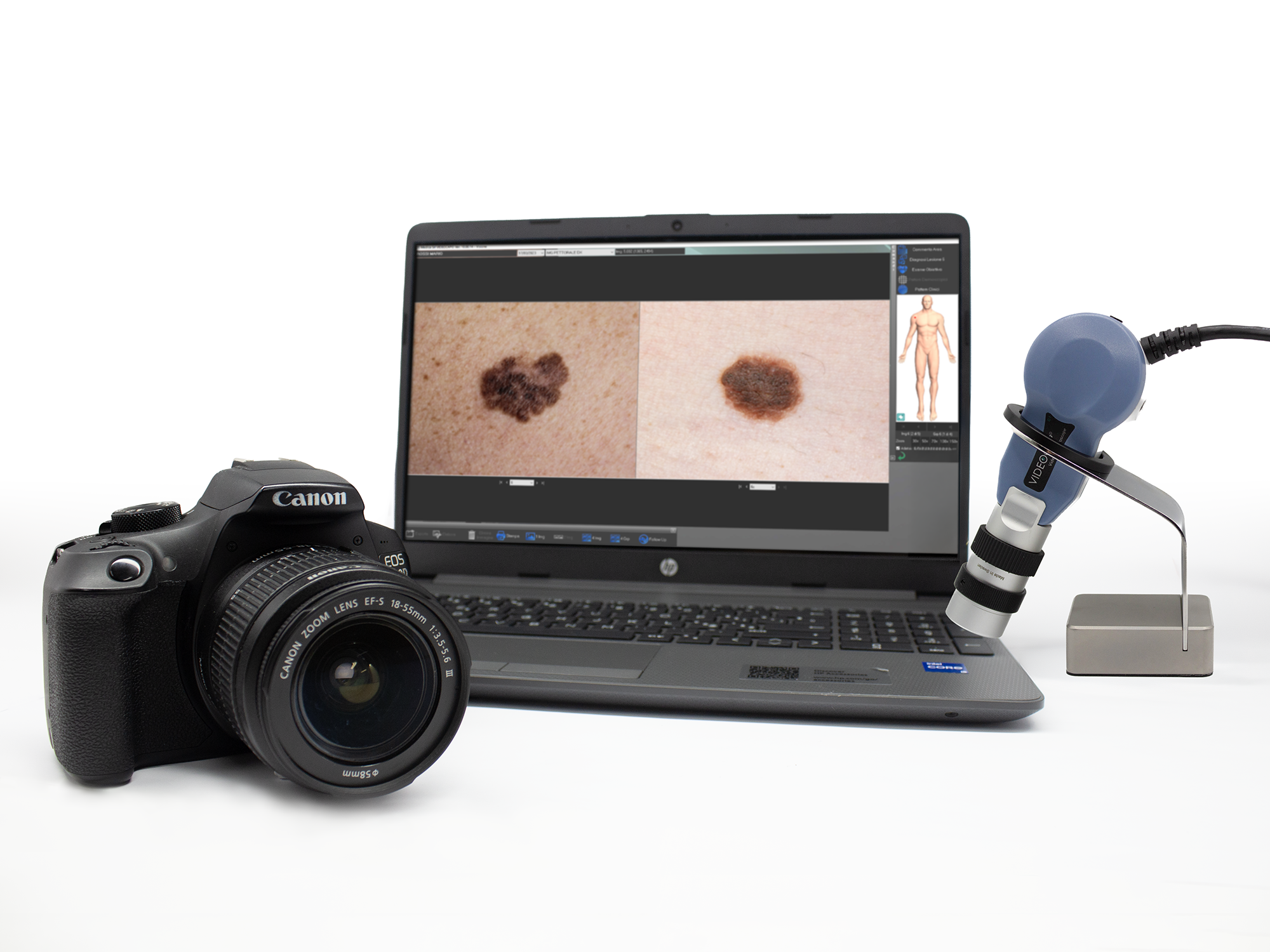 Kit Videocap Mapping Derma